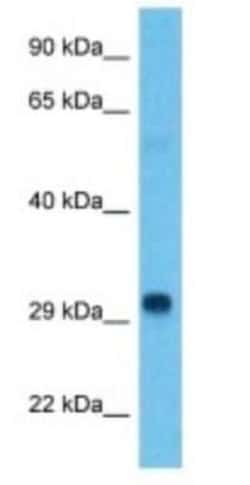 Histone H1.3 Rabbit anti-Human, Polyclonal, Novus Biologicals:Antibodies:Primary